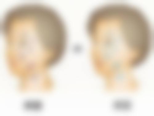 打了下巴多久可以化妆