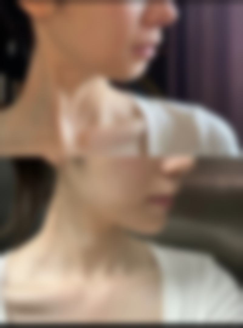 【王显滕医生技术特点】