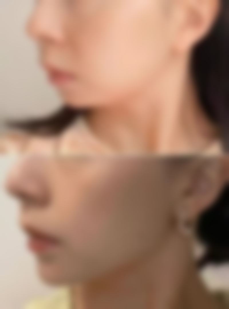 【泰州皇盛美医疗美容诊所参考价格表：】