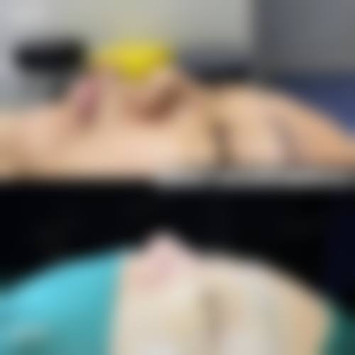 江阴禾沐整形医院提供的项目十分丰富,涵盖了医疗美容服务、生活美容服务、化妆品批发与零售、卫生用品和一次性使用医疗用品销售、远程健康管理服务及养生保健服务等。无论是想要改善面部轮廓、进行皮肤护理,还是购买相关的美容用品,在这里都能找到适合自己的选择。