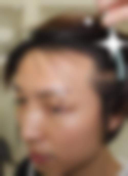 郑州肤康植发科
