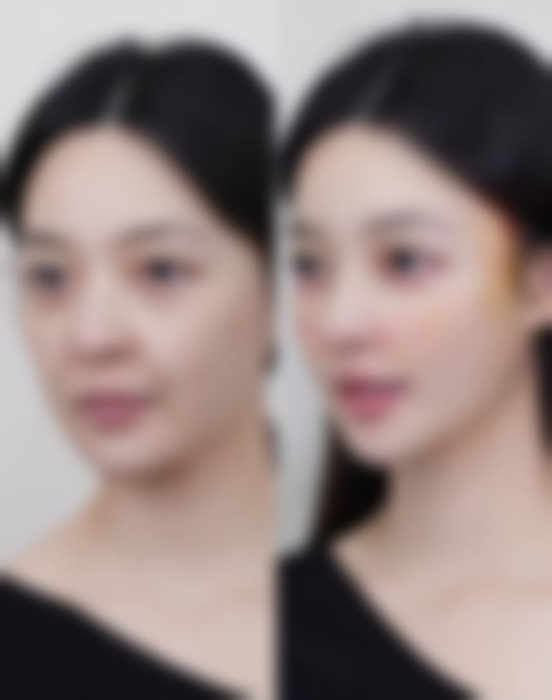 【程东海医生擅长项目】