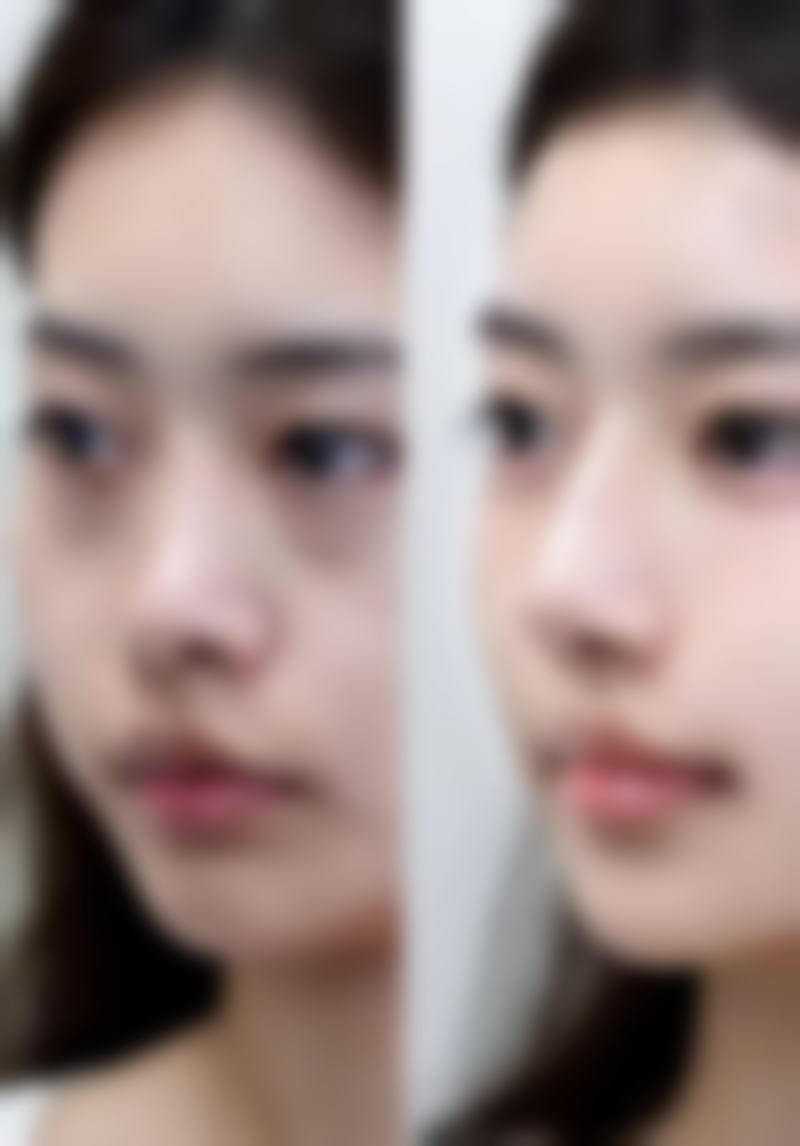 江阴禾沐整形医院是正规靠谱的医美机构。它有着明确的注册信息,统一社会信用代码为91320281MACBUNR58A,工商注册号为320281001316903,登记于江阴市行政审批局。这些信息足以证明它是经过相关部门认可和监管的正规医美机构,大家可以放心前往。
