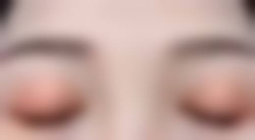 做面部除皱哪儿好？揭秘排名前5的医美机构，技术先进效果显著，让你轻松告别皱纹烦恼！ 