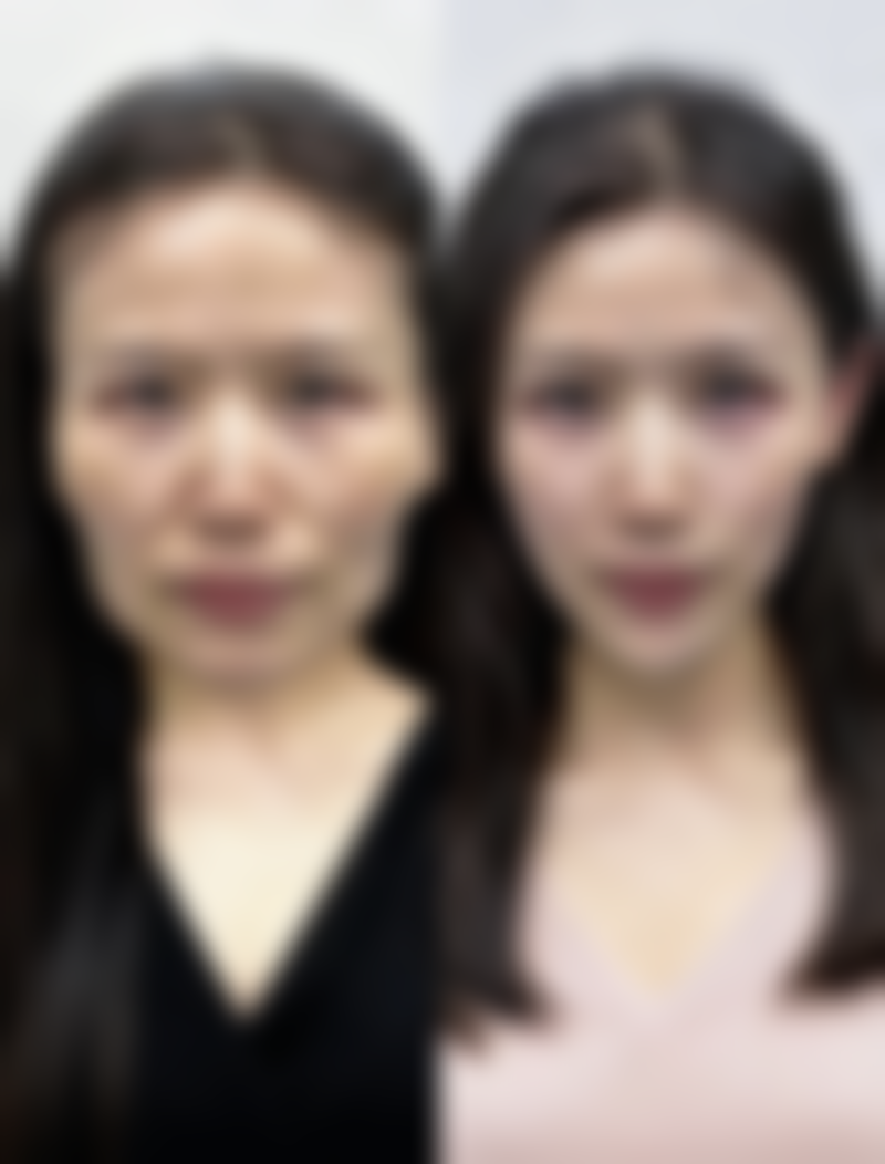 替代美白方法