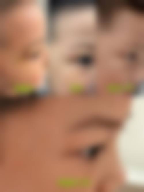 【宁波海曙芙艾医疗美容诊所怎么预约挂号?】
