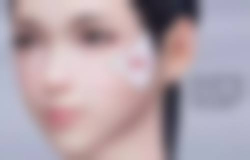 打完瘦脸针8天了感觉脸还是肿的