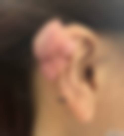【南京万艾特整形医院患者口碑评价:】