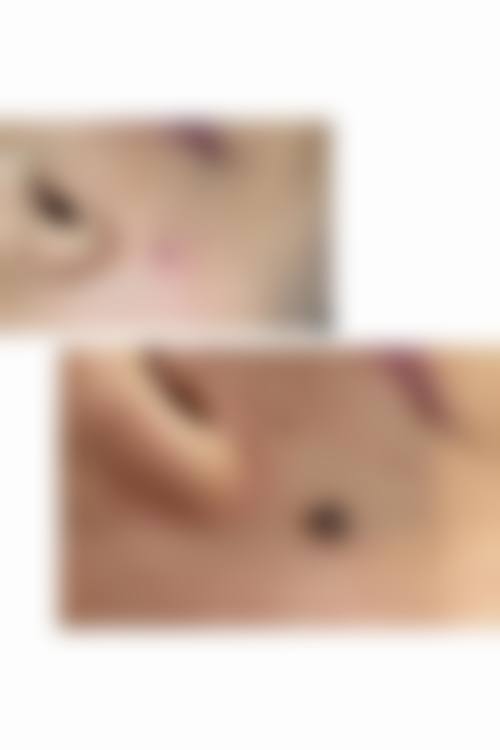 【全仁基医生技术特点】
