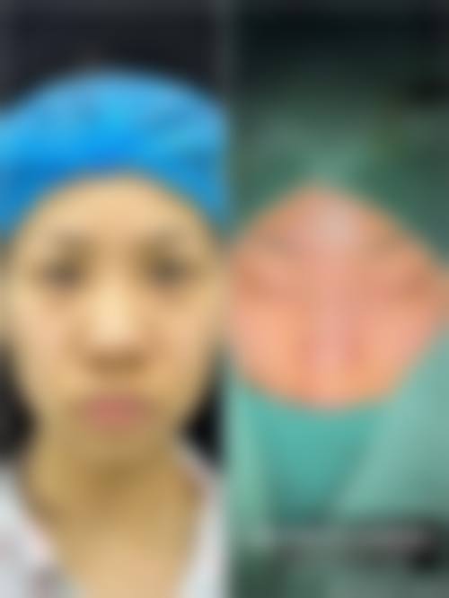 【夏厚林医生技术特点:】
