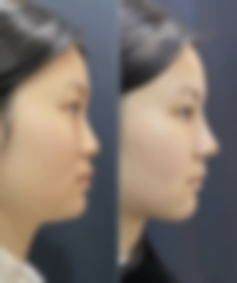 【中山南华整形美容医院患者口碑评价:】
