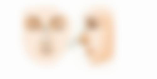 种植头发3500单位照片