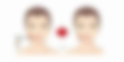 打了除皱针喝了酒会怎样