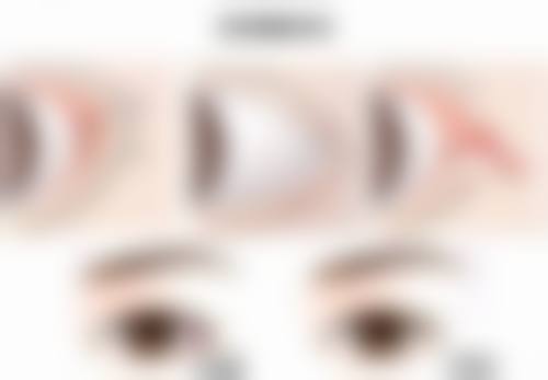 打瘦脸针对以后的影响