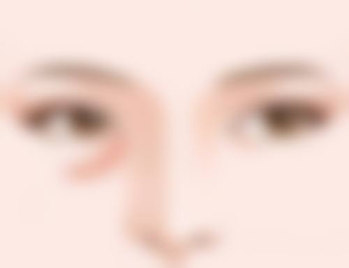 射频除皱能维持多久