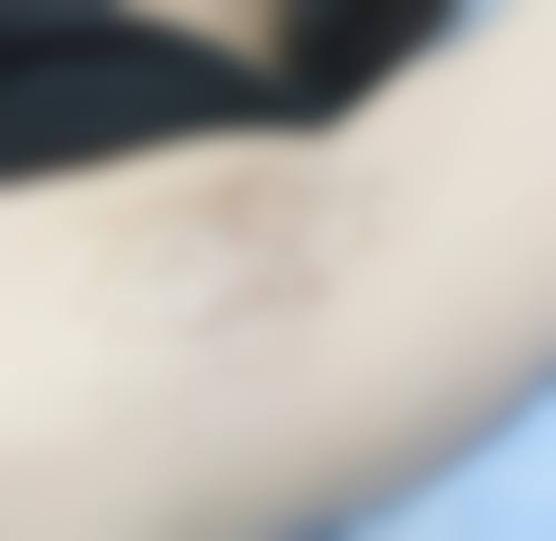 【医生擅长项目】