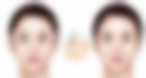 种植头发是怎么操作的视频
