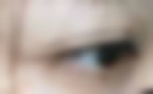 40岁男人割包皮的必要性
