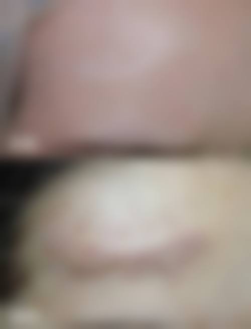 【武汉欣悦整形美容怎么预约挂号?】