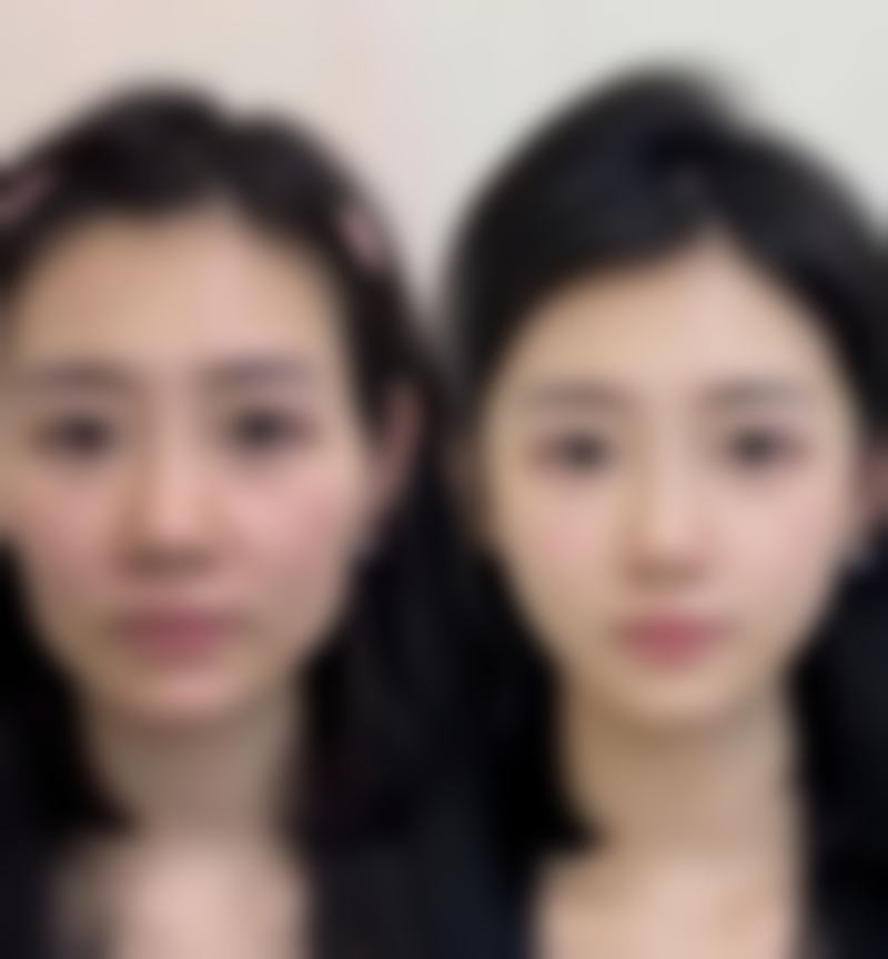 割了包皮能延长性生活吗(男性角度)