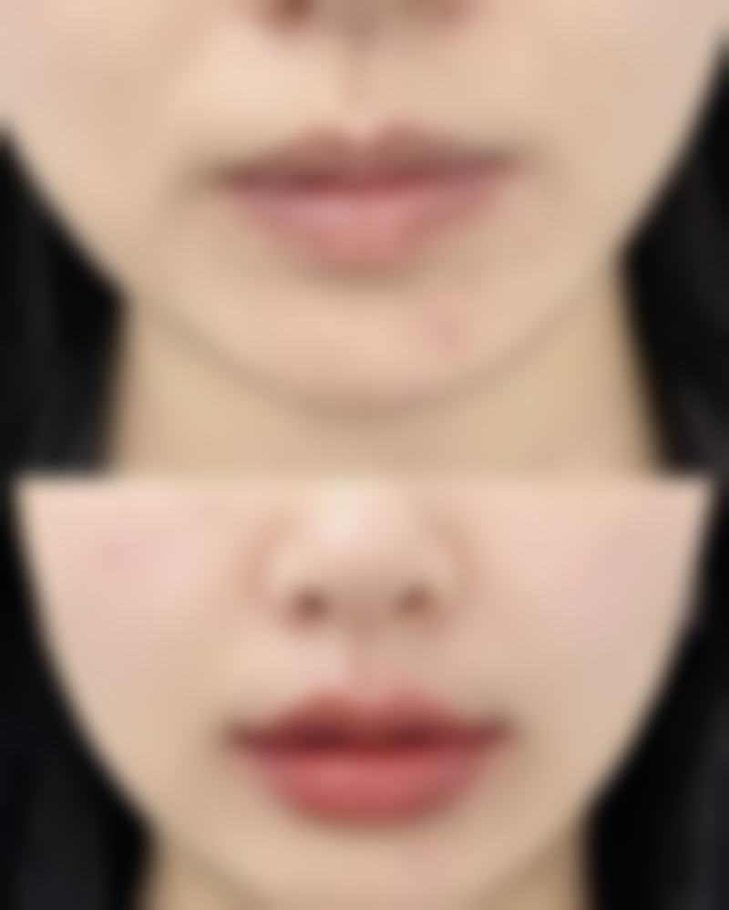 不同人群的选择