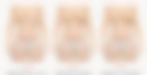 打完瘦脸针8天了感觉脸还是肿的