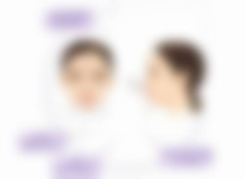 唇组织缺损不超过全唇的1/3 处理方法