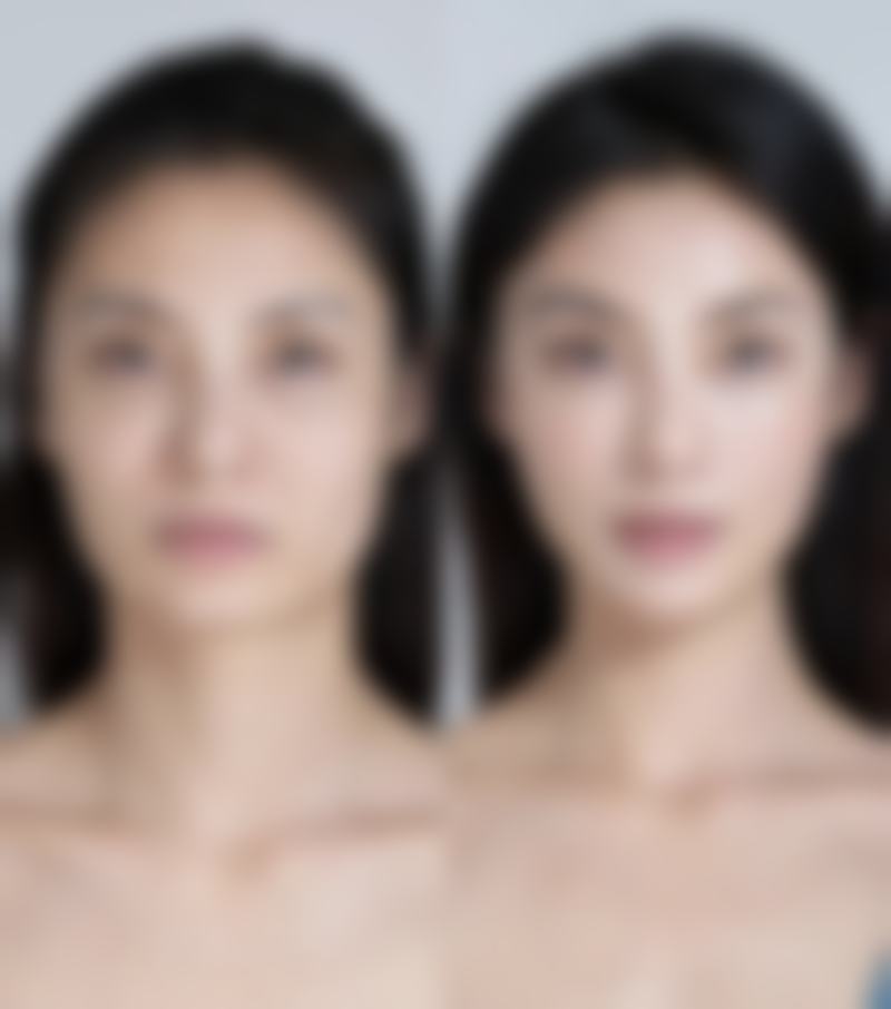 瘦脸针打一次维持多久