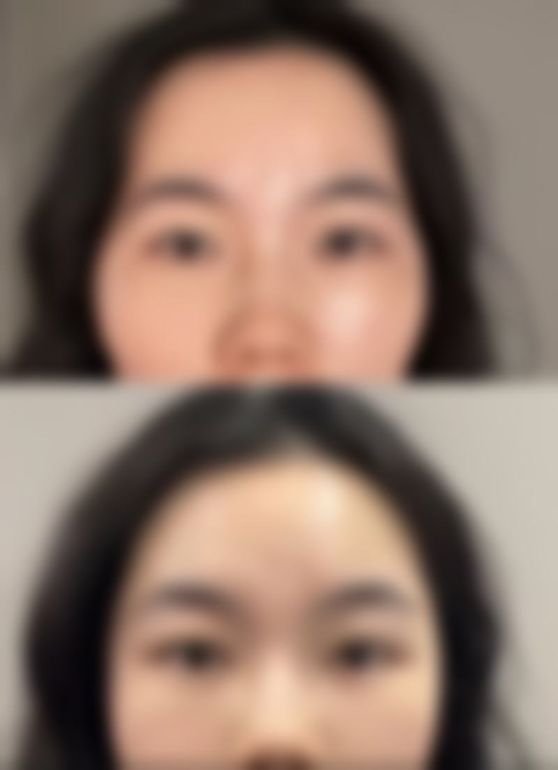 除皱方法图片展示