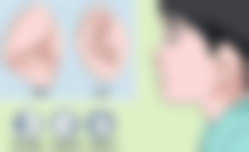 不同年龄段植发的情况