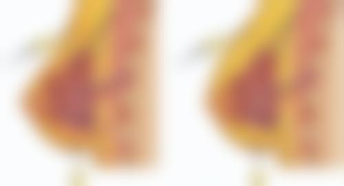 种植头发头发可以生长吗