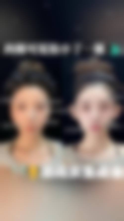 【哈尔滨雅美整形医院怎么预约挂号?】