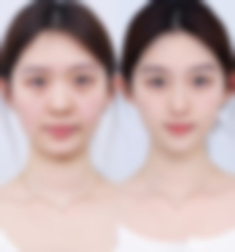【哈尔滨雅美整形医院特色项目:】
