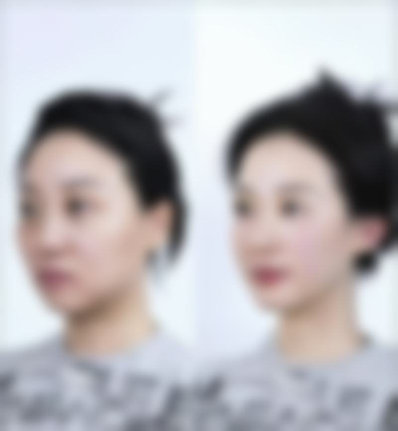 【杭州韩佳医疗整形门诊部患者口碑评价:】