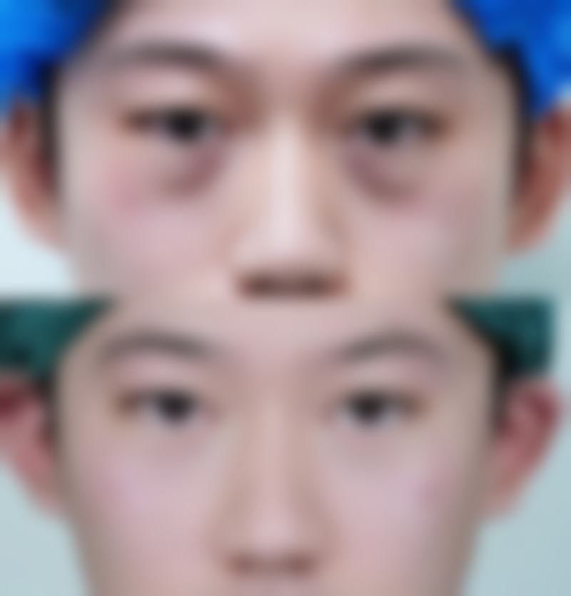【青岛天美整形医院特色项目:】