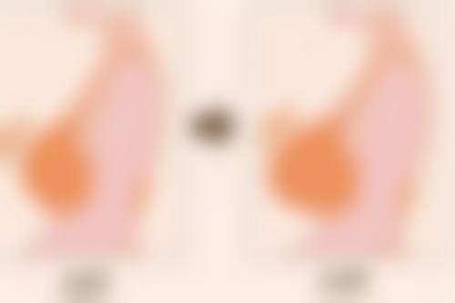 【武汉丽婵整形医院参考价格表:】
