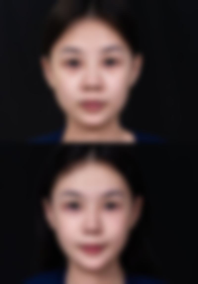 【武汉丽婵整形医院患者口碑评价:】