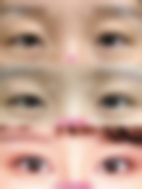 【安庆市第一人民医院整形外科参考价格表:】