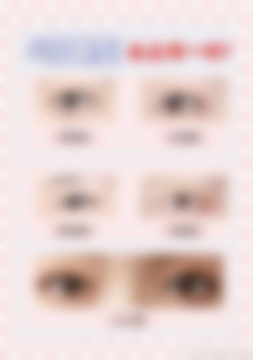 【合肥丽人女子医院中韩整形美容中 心是正规的吗?】