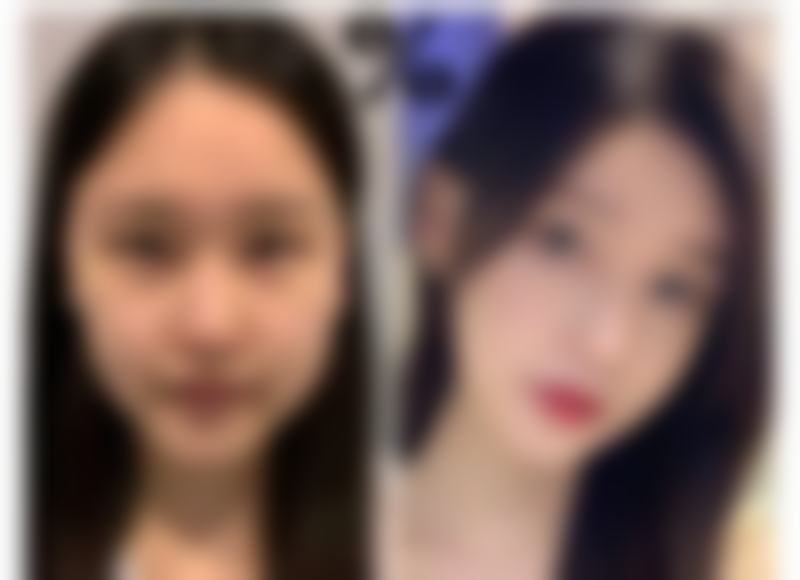 【合肥丽人女子医院中韩整形美容中 心参考价格表:】