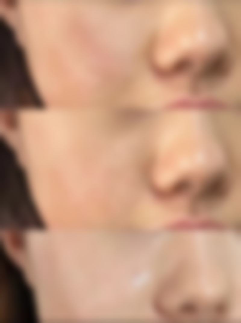 【陈新光医生技术特点】