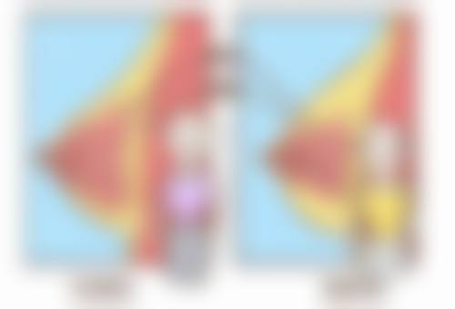假体太阳穴填充多少钱