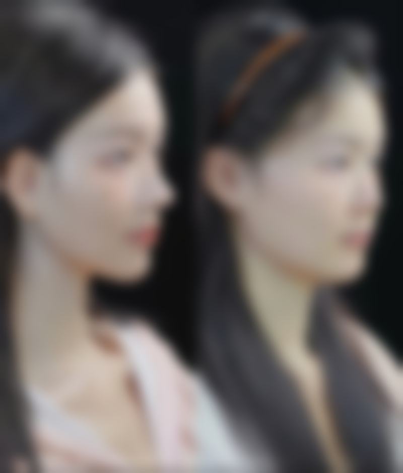 【河池市第三人民医院整形美容科参考价格表:】