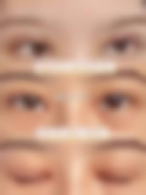 预约优惠活动：韩国高兰得整容外科崔裕炅