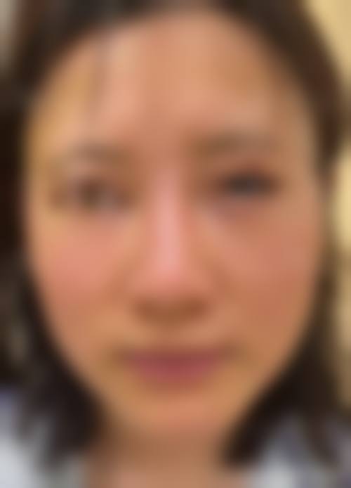 擅长项目详解：韩国高兰得整容外科崔裕炅