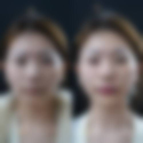 【新疆青松星范医疗美容门诊部参考价格表：】