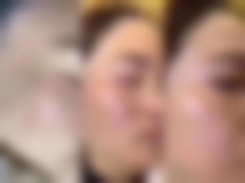 诊疗特色总结：韩国高兰得整容外科崔裕炅