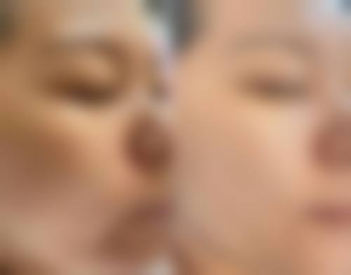 FAQ：关于韩国高兰得整容外科崔裕炅