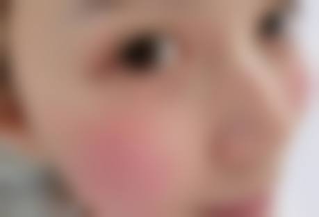 结尾预约号召：立即行动，重拾美丽肌肤