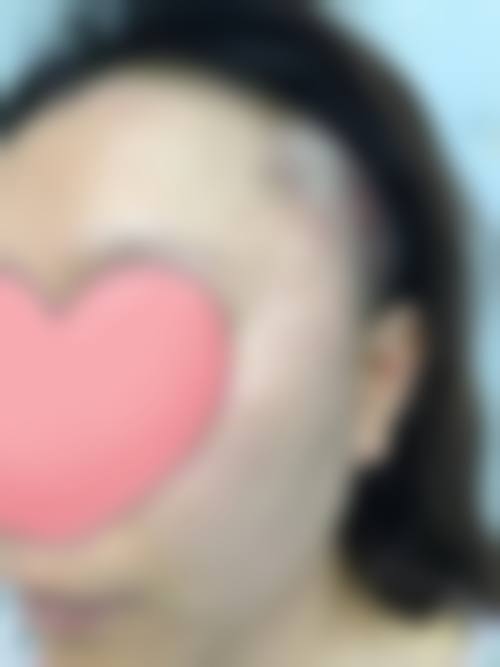 诊疗特色总结：池州佳美皮肤美容医院孟宪兵优势在哪